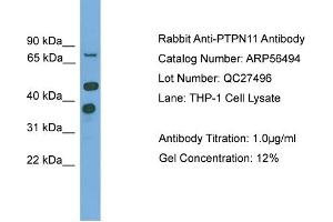 WB Suggested Anti-PTPN11  Antibody Titration: 0. (PTPN11 抗体  (N-Term))