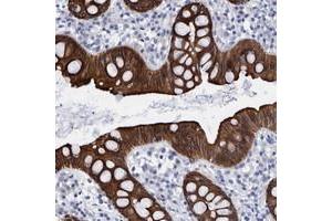 Immunohistochemical staining of human rectum with MKS1 polyclonal antibody  strong cytoplasmic positivity in glandular cells. (MKS1 抗体)