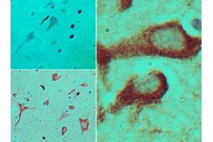 Immunohistochemical analysis of TICAM2 in formalin-fixed, paraffin-embedded human brain tissue using an isotype control (top left) and TICAM2 polyclonal antibody  (bottom left, right) at 5 ug/mL . (TICAM2 抗体  (AA 87-103))