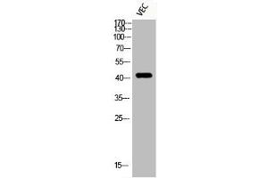 Western Blot analysis of VEC cells using Phospho-HDAC8 (S39) Polyclonal Antibody (HDAC8 抗体  (pSer39))