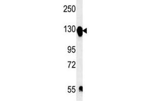 Integrin alpha 5 antibody western blot analysis in mouse bladder tissue lysate. (ITGA5 抗体  (AA 796-822))