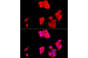 Immunofluorescence analysis of HeLa cells using [KO Validated] SIRT1 Rabbit pAb (ABIN7270322) at dilution of 1:200 (40x lens). (SIRT1 抗体)