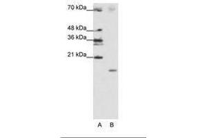 Image no. 2 for anti-Signal Recognition Particle 19kDa (SRP19) (C-Term) antibody (ABIN202029) (SRP19 抗体  (C-Term))
