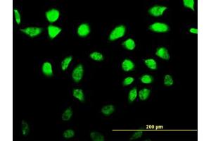 Image no. 1 for anti-A Kinase (PRKA) Anchor Protein 17A (AKAP17A) (AA 53-157) antibody (ABIN599035) (SFRS17A 抗体  (AA 53-157))