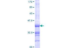 Plakophilin 1 Protein (PKP1) (AA 61-159) (GST tag)