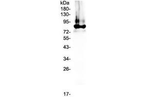 Western blot testing of human plasma lysate with Prothrombin antibody at 0. (Prothrombin 抗体)