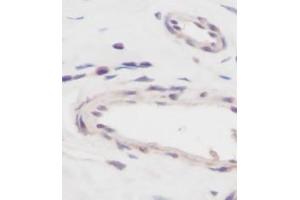 Image no. 5 for anti-Vascular Endothelial Growth Factor A (VEGFA) antibody (ABIN465470) (VEGFA 抗体)