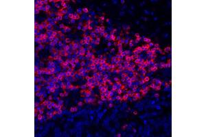 Immunofluorescence (IF) image for anti-CD3 epsilon (CD3E) (AA 157-207) antibody (ABIN7454035) (Recombinant CD3 epsilon 抗体  (AA 157-207))