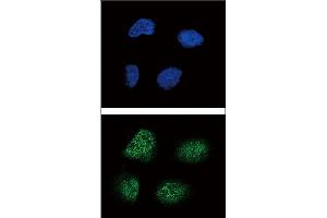 Confocal immunofluorescent analysis of Neurogenin3 Antibody (N-term) (ABIN388770 and ABIN2839081) with NCI- cell followed by Alexa Fluor 488-conjugated goat anti-rabbit lgG (green).