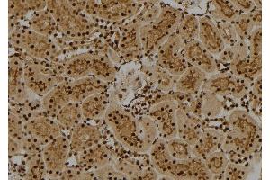 ABIN6261828 and ABIN6274011 at 1/100 staining Rat kidney tissue by IHC-P. (FUBP1 抗体  (C-Term))