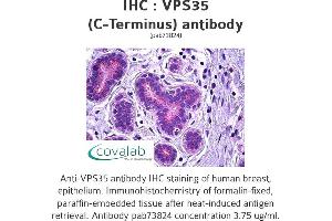Image no. 1 for anti-Vacuolar Protein Sorting 35 (VPS35) (C-Term) antibody (ABIN1740787) (VPS35 抗体  (C-Term))
