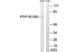 Western Blotting (WB) image for anti-Protein Phosphatase 1, Regulatory Subunit 16B (PPP1R16B) (AA 364-413) antibody (ABIN2890540) (PPP1R16B 抗体  (AA 364-413))