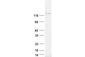 Western Blotting (WB) image for Phosphoribosylformylglycinamidine Synthase (PFAS) protein (Myc-DYKDDDDK Tag) (ABIN2728721)