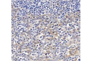 Immunohistochemistry analysis of paraffin-embedded human tonsil using,OAS3 (ABIN7072846) at dilution of 1: 4000 (OAS3 抗体)