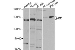 Western blot analysis of extracts of various cell lines, using CP Antibody (ABIN5974460) at 1/1000 dilution. (Ceruloplasmin 抗体)