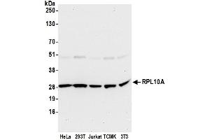 anti-Ribosomal Protein L10a (RPL10A) (AA 167-217) antibody