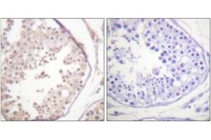 Immunohistochemistry analysis of paraffin-embedded human testis tissue, using RAD52 (Ab-104) Antibody. (RAD52 抗体  (AA 70-119))
