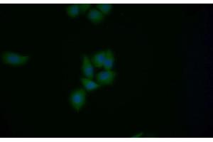 Detection of MGEA5 in Human MCF7 cell using Polyclonal Antibody to Meningioma Expressed Antigen 5 (MGEA5) (MGEA5 抗体  (AA 6-240))