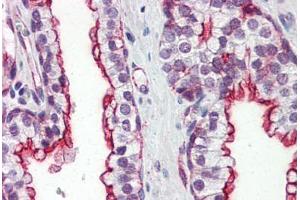 Human Prostate (formalin-fixed, paraffin-embedded) stained with CLU antibody ABIN364331 at 10 ug/ml followed by biotinylated anti-mouse IgG secondary antibody ABIN481714, alkaline phosphatase-streptavidin and chromogen. (Clusterin 抗体  (AA 1-333))