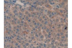 Immunohistochemistry (IHC) image for anti-Matrix Metallopeptidase 9 (Gelatinase B, 92kDa Gelatinase, 92kDa Type IV Collagenase) (MMP9) (AA 226-391) antibody (ABIN7432019)