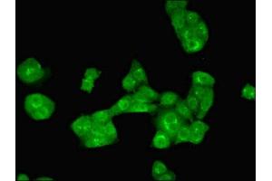 Immunofluorescent analysis of PC-3 cells using ABIN7143886 at dilution of 1:100 and Alexa Fluor 488-congugated AffiniPure Goat Anti-Rabbit IgG(H+L) (ALKBH3 抗体  (AA 1-170))