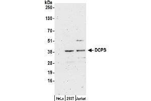 Western Blotting (WB) image for anti-Decapping Enzyme, Scavenger (DCPS) (AA 287-337) antibody (ABIN7450156)