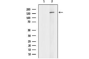 Western blot analysis of lysates from HepG2 cells, using NUP153 Antibody.
