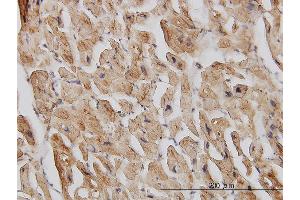 Immunoperoxidase of monoclonal antibody to EIF4G2 on formalin-fixed paraffin-embedded human heart. (EIF4G2 抗体  (AA 811-889))