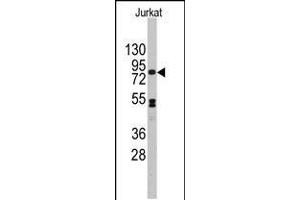 Western blot analysis of anti-CDH12 Antibody in Jurkat cell line lysates (35ug/lane). (Cadherin 12 抗体  (N-Term))
