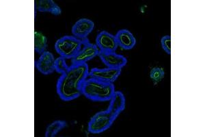 IF analysis of Villin using anti-Villin antibody (ABIN3042343).
