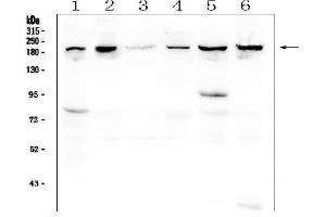 Western blot analysis of CPAMD8 using anti-CPAMD8 antibody (ABIN6719649). (CPAMD8 抗体  (AA 58-234))