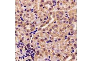 Immunohistochemical analysis of AK4 staining in rat kidney formalin fixed paraffin embedded tissue section. (AK4 抗体)