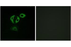 Immunofluorescence (IF) image for anti-Transforming, Acidic Coiled-Coil Containing Protein 3 (TACC3) (AA 789-838) antibody (ABIN2890716) (TACC3 抗体  (AA 789-838))