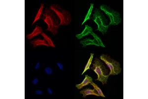 ABIN6258908 and ABIN6275622 staining Hela cells by IF/ICC. (CD1e 抗体  (Internal Region))