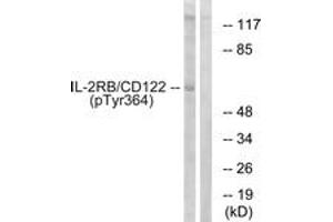 Western blot analysis of extracts from COS7 cells, using IL-2R beta/CD122 (Phospho-Tyr364) Antibody. (IL2 Receptor beta 抗体  (pTyr364))