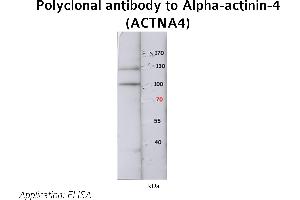 Image no. 1 for anti-Actinin, alpha 4 (ACTN4) (N-Term) antibody (ABIN347113) (alpha Actinin 4 抗体  (N-Term))
