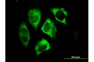 Immunofluorescence of monoclonal antibody to PARK2 on HeLa cell. (Parkin 抗体  (AA 288-387))