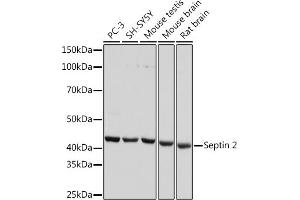 Western blot analysis of extracts of various cell lines, using Septin 2 Rabbit mAb (ABIN7270203) at 1:1000 dilution. (Septin 2 抗体)