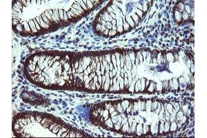 Immunohistochemical staining of paraffin-embedded Human colon tissue using anti-TBCC mouse monoclonal antibody. (TBCC 抗体)