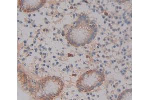 Immunohistochemistry (IHC) image for anti-ATP-Binding Cassette, Sub-Family A (ABC1), Member 12 (ABCA12) (AA 1346-1577) antibody (ABIN5013169)