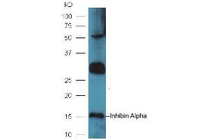 Mouse intestinal lysates probed with Rabbit Anti-Inhibin Alpha Polyclonal Antibody, Unconjugated (ABIN1715125) at 1:300 in 4˚C. (Inhibin alpha 抗体  (AA 281-366))