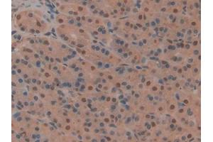 IHC-P analysis of Rat Stomach Tissue, with DAB staining. (CD2AP 抗体  (AA 368-623))