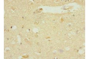 Immunohistochemistry of paraffin-embedded human brain tissue using ABIN7150519 at dilution of 1:100 (DNAJB2 抗体  (AA 215-324))