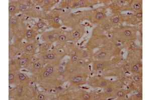 Immunohistochemistry (IHC) image for anti-Olfactory Receptor, Family 4, Subfamily C, Member 15 (OR4C15) (AA 258-268) antibody (ABIN7139992)