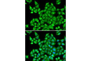 Immunofluorescence analysis of HeLa cells using DHRS9 antibody. (DHRS9 抗体)