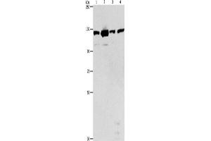 Western Blotting (WB) image for anti-PTK2 Protein tyrosine Kinase 2 (PTK2) antibody (ABIN2422852) (FAK 抗体)