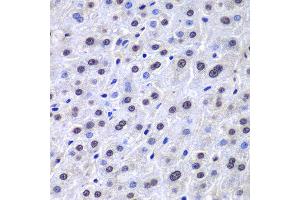 Immunohistochemistry of paraffin-embedded human liver injury using APEX1 antibody at dilution of 1:100 (400x lens). (APEX1 抗体)