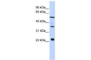 CENPM antibody used at 1 ug/ml to detect target protein. (CENPM 抗体  (Middle Region))