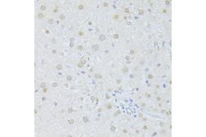 Immunohistochemistry of paraffin-embedded rat liver using SIRT1 antibody (ABIN6291361) at dilution of 1:100 (40x lens). (SIRT1 抗体)