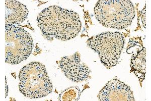 ABIN6265248 and ABIN6278995 at 1/100 staining Mouse testis tissue by IHC-P. (SP5 抗体  (Internal Region))
